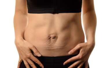 Diastasis recti self-check, Women’s Health Physiotherapist at The Health Hub Haywards Heath